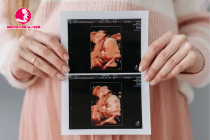 Agar Bayi Lahir Sehat dan Ibu Selamat: Panduan Lengkap untuk Ibu Hamil